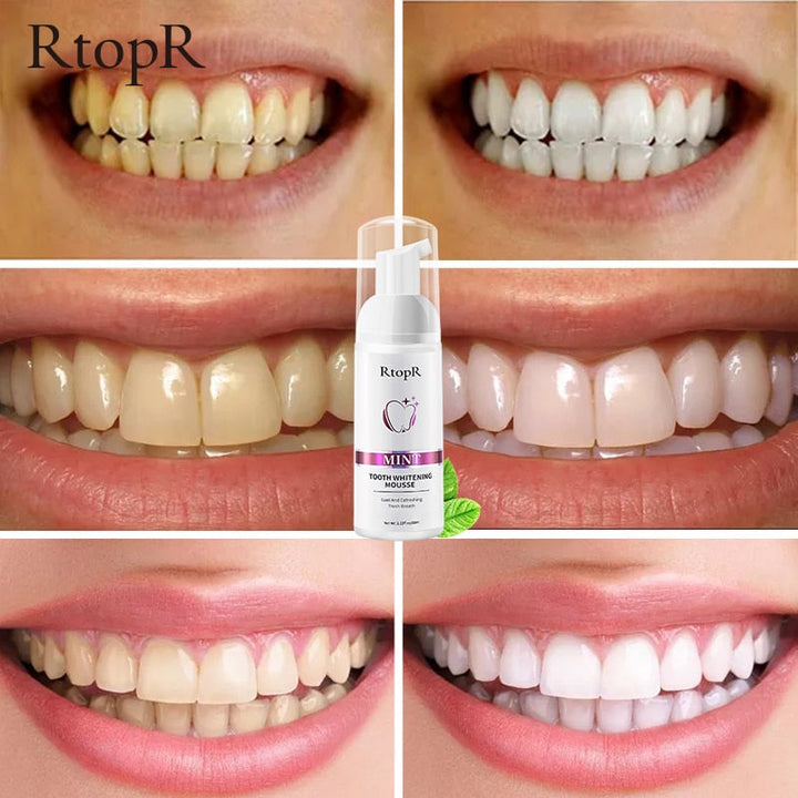 Tooth Whitening Mousse: Logra una Sonrisa Radiante Desde Casa